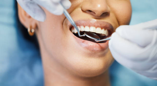 Best Emergency Dental Care for Broken or Chipped Teeth in Monticello, MS